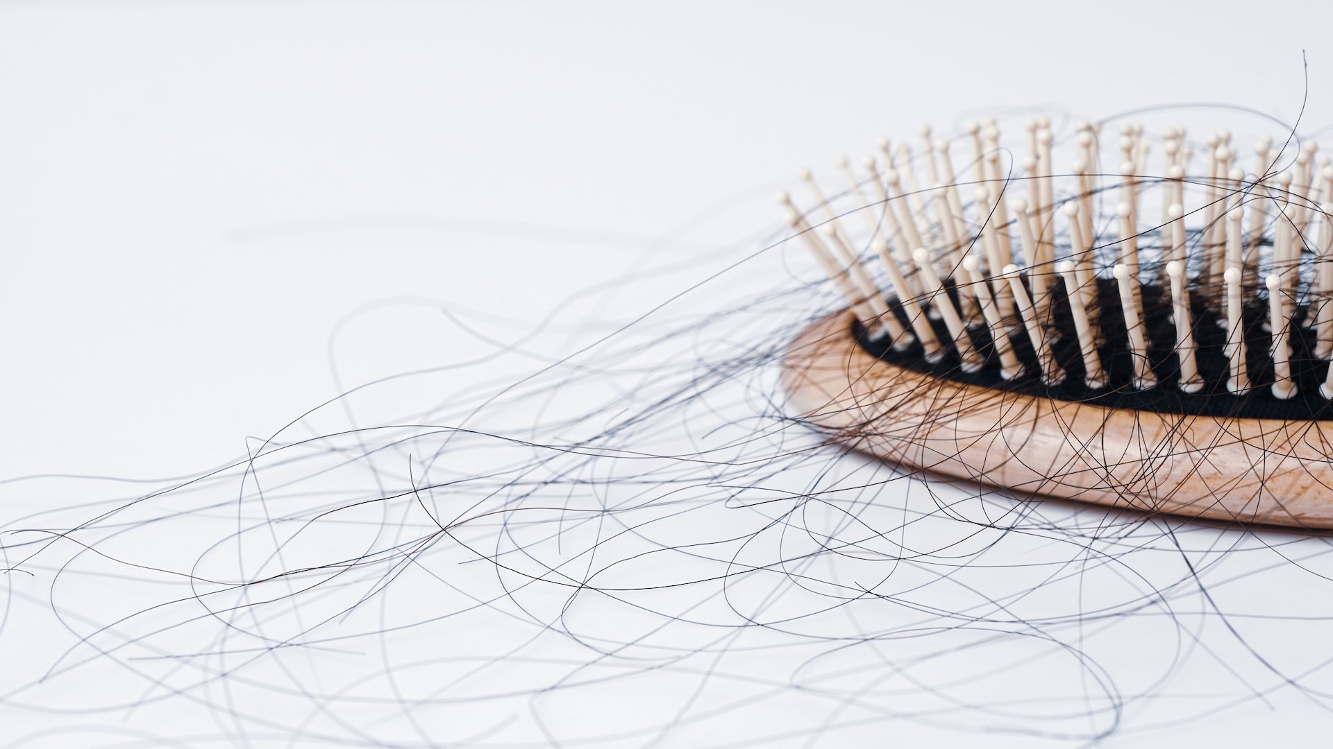 What Is Hair Loss? Types, Causes, and When to Worry